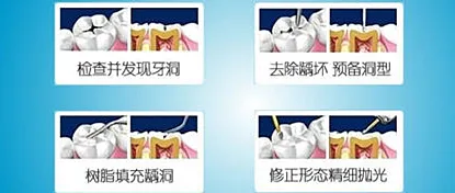 补牙疼吗？补牙的过程疼不疼-资料巴巴网
